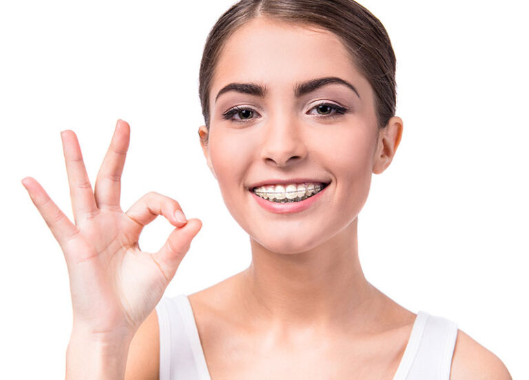 Know the Basics of Wearing Braces - The Avenue Dental